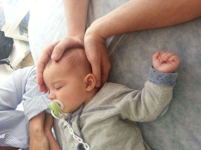 que es la plagiocefalia