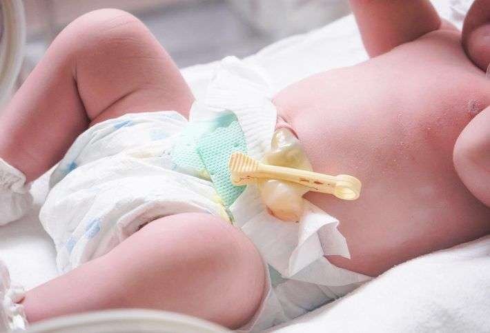 como cuidar el cordon umbilical