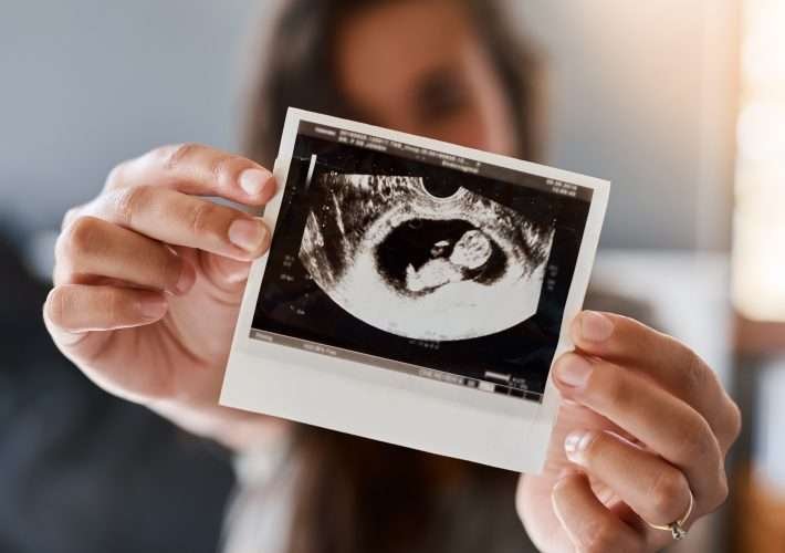 ecografía del bebé